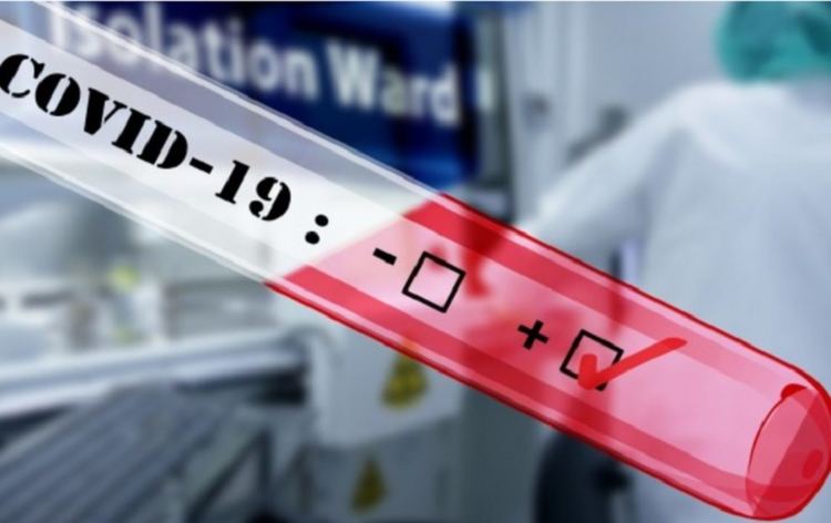 16 са новите случая на КОВИД-19 у нас на 24 март