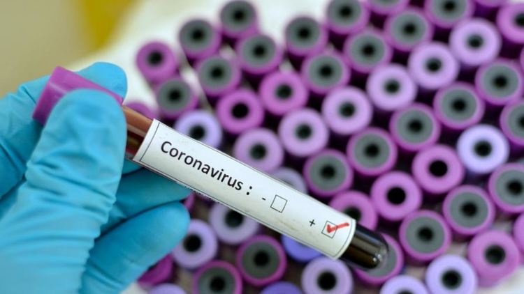 Три нови случая на covid-19 в Смолянска област, други двама са починали