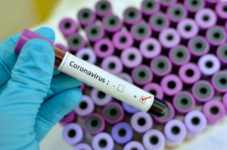 572 са новите случаи на COVID-19 в област Пловдив 