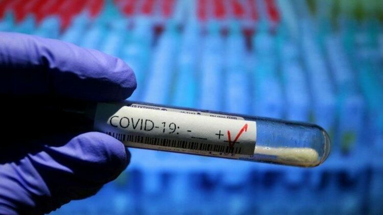 512 са новите случаи на COVID-19 през изминалите почивни дни в област Пловдив